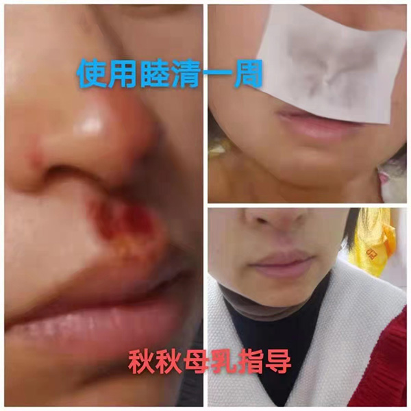 �����澏���N���Æ᣿���M�߿ڱ������������a(ch��n)ƷȦ�۟o��(sh��)